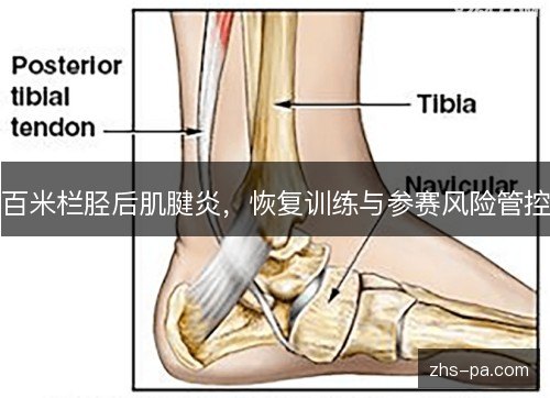 百米栏胫后肌腱炎，恢复训练与参赛风险管控